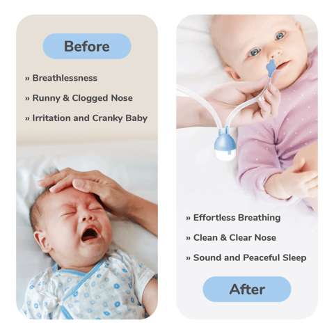 R for Rabbit Snowy Nasal Cleaner For Baby Painless Relief From Mucus And Blocked Nose Blue