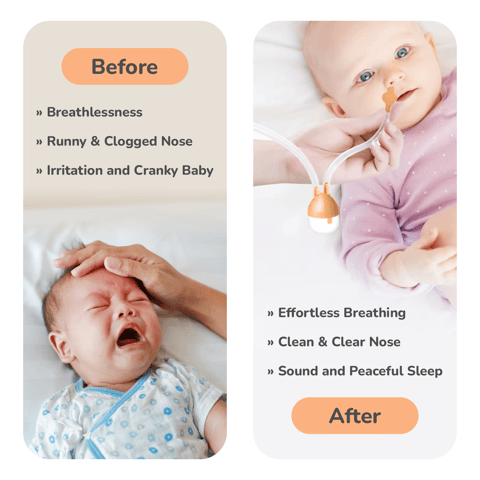 R for Rabbit Snowy Nasal Cleaner For Baby Painless Relief From Mucus And Blocked Nose Orange